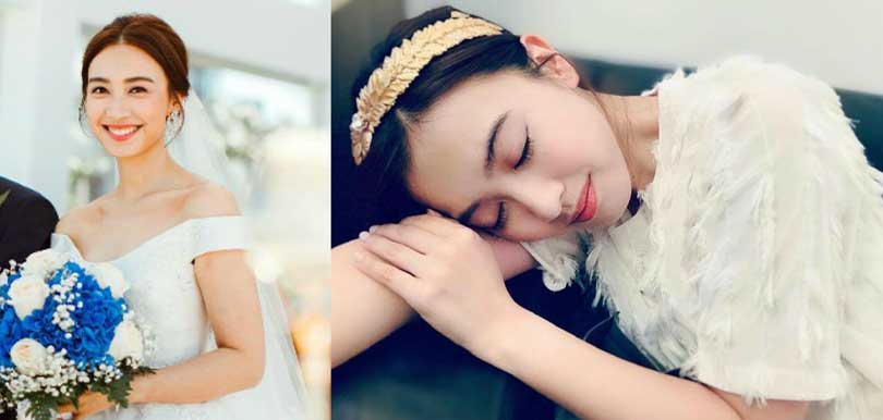 婚前keep住靚皮膚  3款適合準新娘的溫和醫美療程