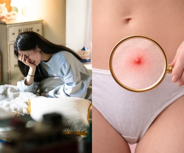 私密處生粒粒心慌慌？了解5大陰部暗瘡的成因及症狀 用手擠是大忌！